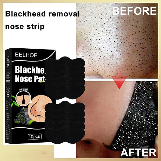 10pcs/Box Blackhead Remover Nose Strips