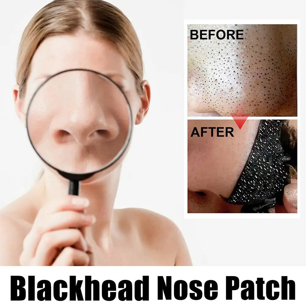 10pcs/Box Blackhead Remover Nose Strips